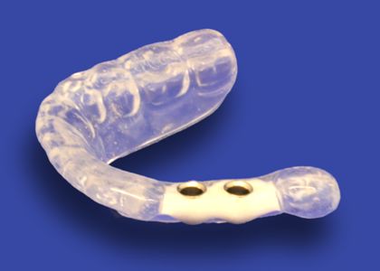 サージカルガイドとは？