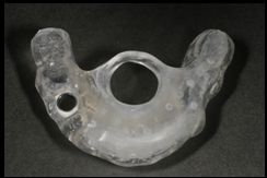 6. 完成したサージカルガイド（SICAT）